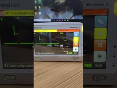 Veja por que escolher a tela LCD do monitor de paciente Mindray BeneView T1 com capa frontal