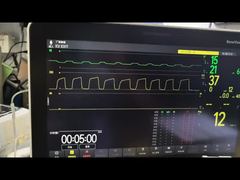 Veja a demonstração do módulo AG da Mindray AG e do módulo O2 MMS PN 115-023943-00